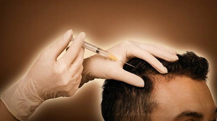 Hair Transplant in Thane: Procedure, Cost, Results & Best Clinic Guide (2026)