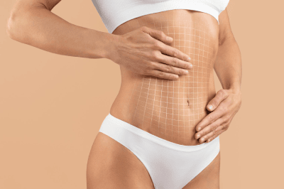 Tummy Tuck Imges